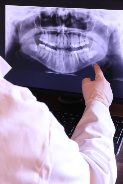 Best Knocked-Out Tooth (Avulsed Tooth) Treatment in Castle Rock, CO