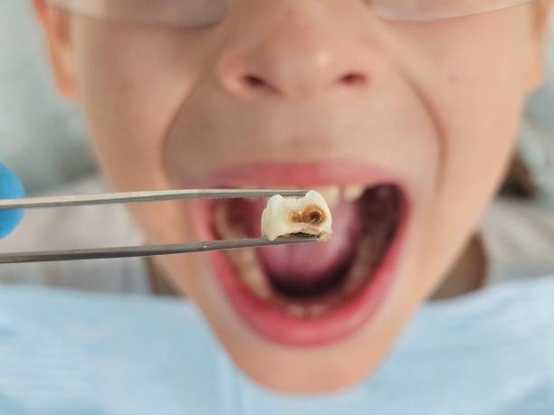 Best Emergency Treatment for Jaw Pain or Injury in Castle Rock, CO